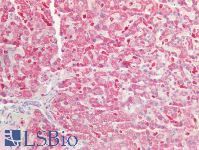 GAS6 Antibody - Human Liver: Formalin-Fixed, Paraffin-Embedded (FFPE)
