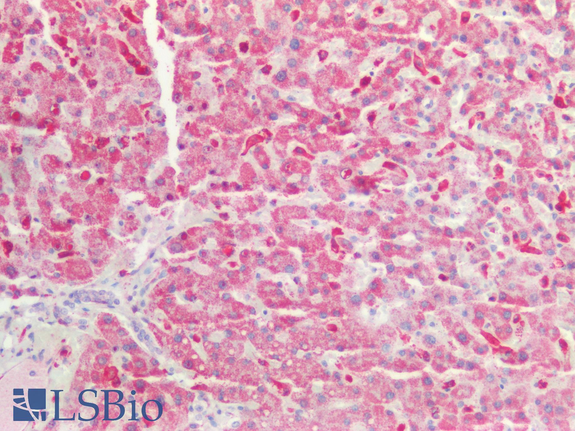 GAS6 Antibody - Human Liver: Formalin-Fixed, Paraffin-Embedded (FFPE)