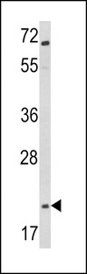 GCG / Glucagon Antibody - Western blot of Glucagon Antibody in Jurkat cell line lysates (35 ug/lane). GCG (arrow) was detected using the purified antibody.