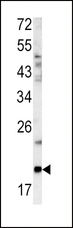 GCG / Glucagon Antibody - Western blot of GCG antibody in mouse bladder tissue lysates (35 ug/lane). GCG (arrow) was detected using the purified antibody.