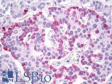 GCG / Glucagon Antibody - Anti-Glucagon antibody IHC of human pancreas, islets of Langerhans. Immunohistochemistry of formalin-fixed, paraffin-embedded tissue after heat-induced antigen retrieval. Antibody dilution 10 ug/ml.