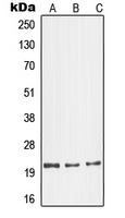 GCG / Glucagon Antibody - Western blot analysis of Glucagon expression in LO2 (A); mouse kidney (B); H9C2 (C) whole cell lysates.