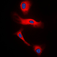 GCG / Glucagon Antibody - Immunofluorescent analysis of Glucagon staining in H9C2 cells. Formalin-fixed cells were permeabilized with 0.1% Triton X-100 in TBS for 5-10 minutes and blocked with 3% BSA-PBS for 30 minutes at room temperature. Cells were probed with the primary antibody in 3% BSA-PBS and incubated overnight at 4 C in a humidified chamber. Cells were washed with PBST and incubated with a DyLight 594-conjugated secondary antibody (red) in PBS at room temperature in the dark. DAPI was used to stain the cell nuclei (blue).