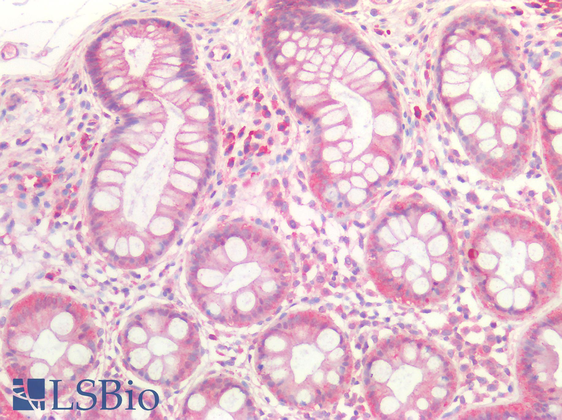 GDF15 Antibody - Human Colon: Formalin-Fixed, Paraffin-Embedded (FFPE)