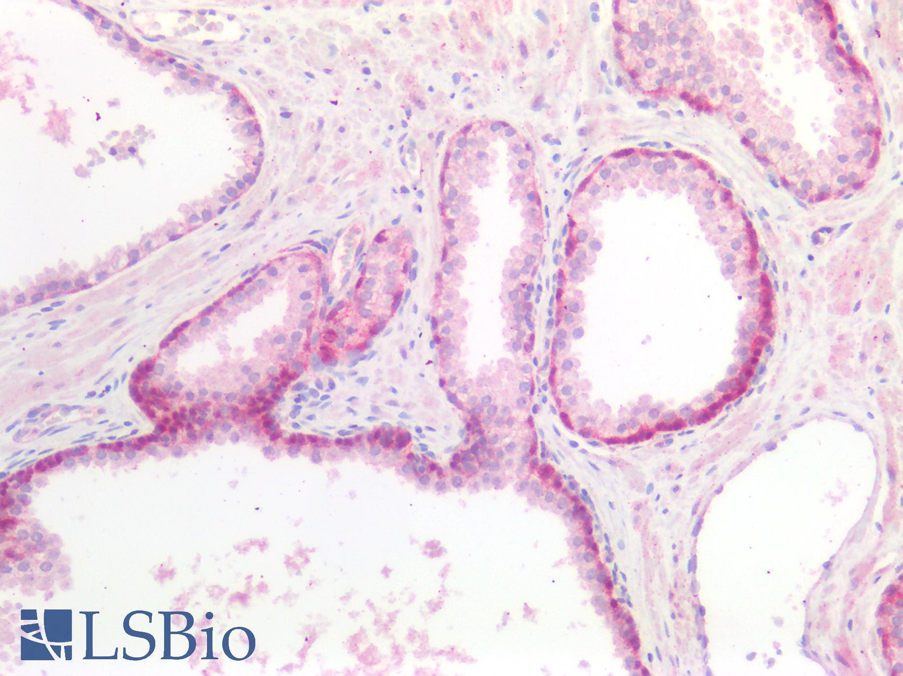 GDF15 Antibody - Human Prostate: Formalin-Fixed, Paraffin-Embedded (FFPE)