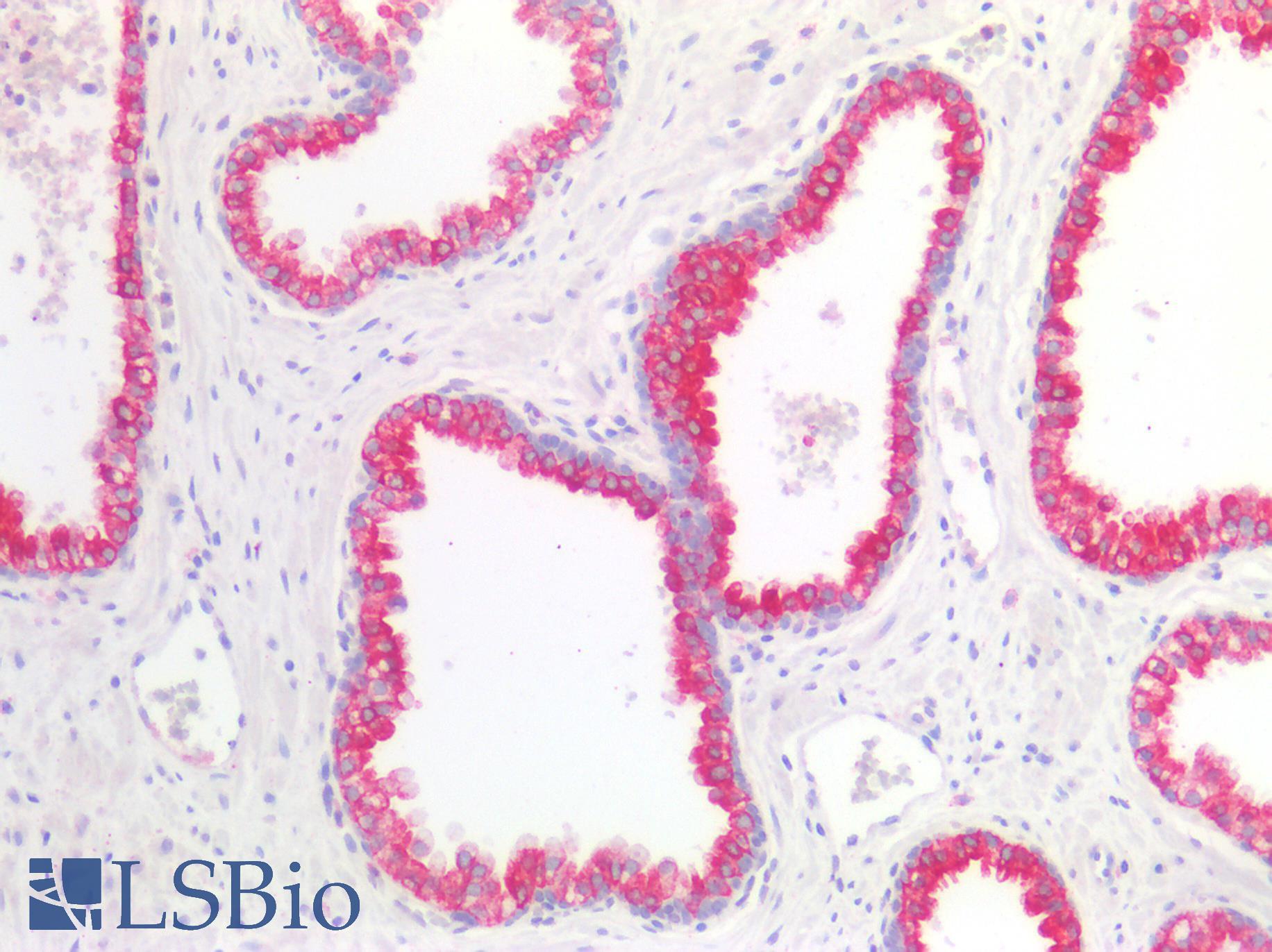GDF15 Antibody - Human Prostate: Formalin-Fixed, Paraffin-Embedded (FFPE)