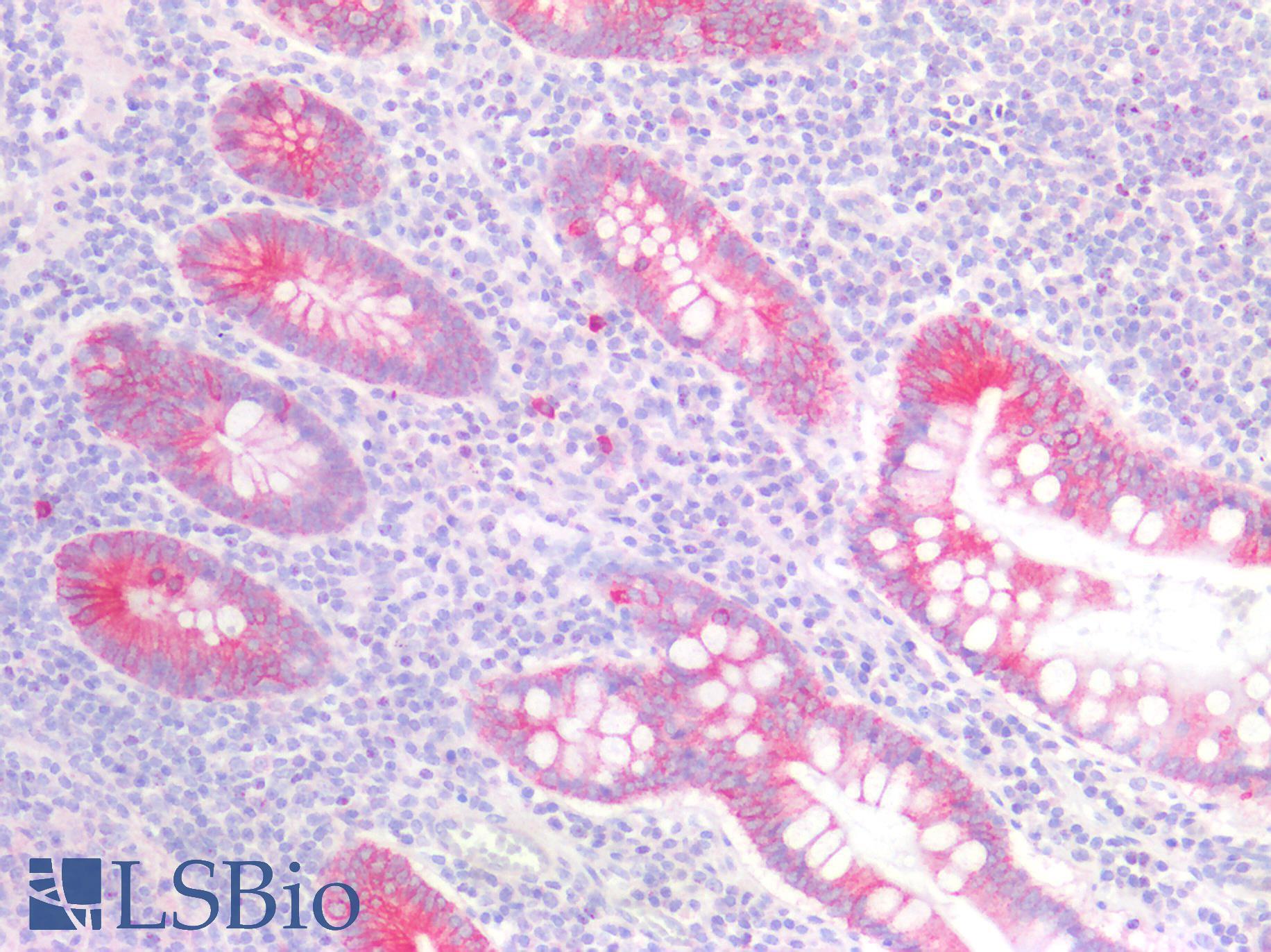 GDF15 Antibody - Human Small Intestine: Formalin-Fixed, Paraffin-Embedded (FFPE)