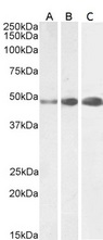 GFAP Antibody - GFAP antibody (0.0003µg/ml) staining of Human Cerebellum (A), (0.3ug/ml) Mouse (B) and Rat (C) Brain lysate (35µg protein in RIPA buffer). Detected by chemiluminescence.