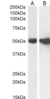 GFAP Antibody - GFAP antibody (0.003µg/ml) staining of Human Cerebellum (A), (0.1ug/ml).Mouse (B) and (0.003µg/ml) Rat (C) Brain lysate (35µg protein in RIPA buffer). Detected by chemiluminescence.