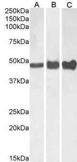 GFAP Antibody - GFAP antibody (0.01µg/ml) staining of Human (A), Mouse (B) and (0.003ug/ml) Rat (C) Brain lysate (35µg protein in RIPA buffer). Detected by chemiluminescence.
