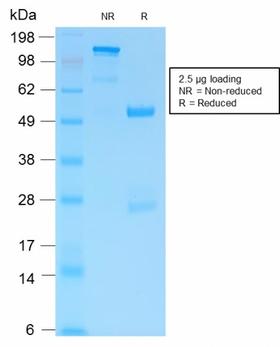 GFAP Antibody - SDS-PAGE Analysis of Purified GFAP Rabbit Recombinant Monoclonal Antibody (ASTRO/1974R). Confirmation of Purity and Integrity of Antibody.