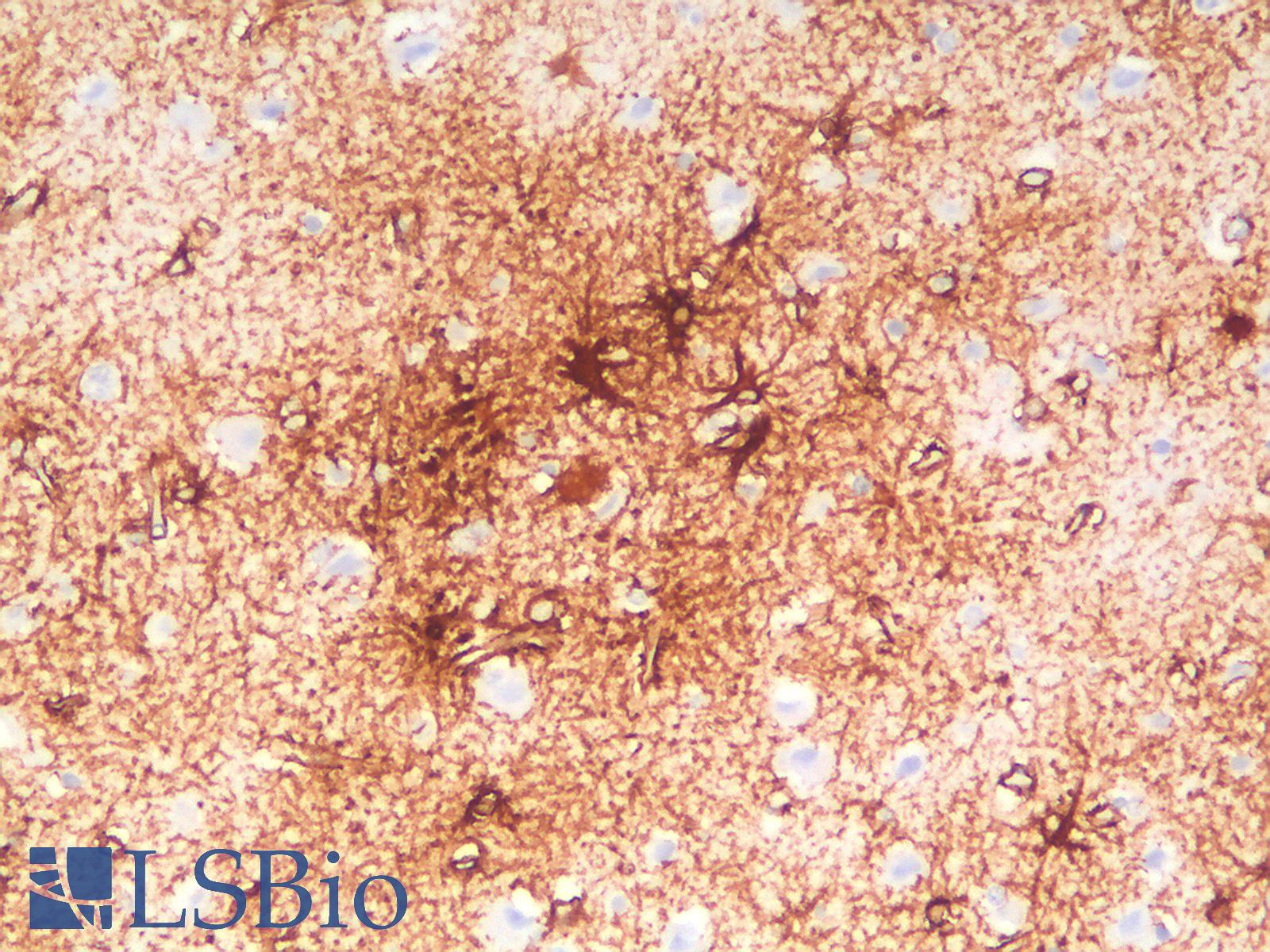 GFAP Antibody - Human Cortex: Formalin-Fixed, Paraffin-Embedded (FFPE)