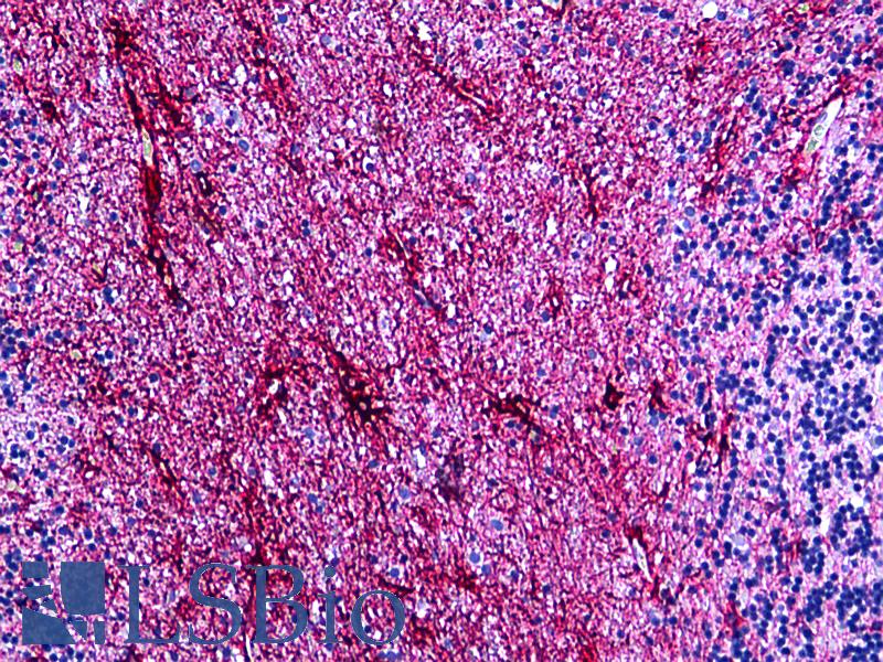 GFAP Antibody - Anti-GFAP antibody IHC of human brain, cerebellum astrocytes. Immunohistochemistry of formalin-fixed, paraffin-embedded tissue after heat-induced antigen retrieval. Antibody dilution 1:100.