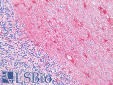 GFAP Antibody - Human Brain, Cerebellum: Formalin-Fixed, Paraffin-Embedded (FFPE)