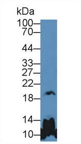 GH / Growth Hormone Antibody - Western Blot; Sample: Mouse Cerebrum lysate; Primary Ab: 5µg/ml Rabbit Anti-Human GH Antibody Second Ab: 0.2µg/mL HRP-Linked Caprine Anti-Rabbit IgG Polyclonal Antibody