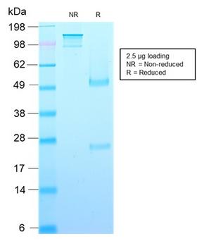 GH / Growth Hormone Antibody - SDS-PAGE Analysis Purified Growth Hormone Recombinant Mouse Monoclonal (rGH/1450). Confirmation of Purity and Integrity of Antibody.