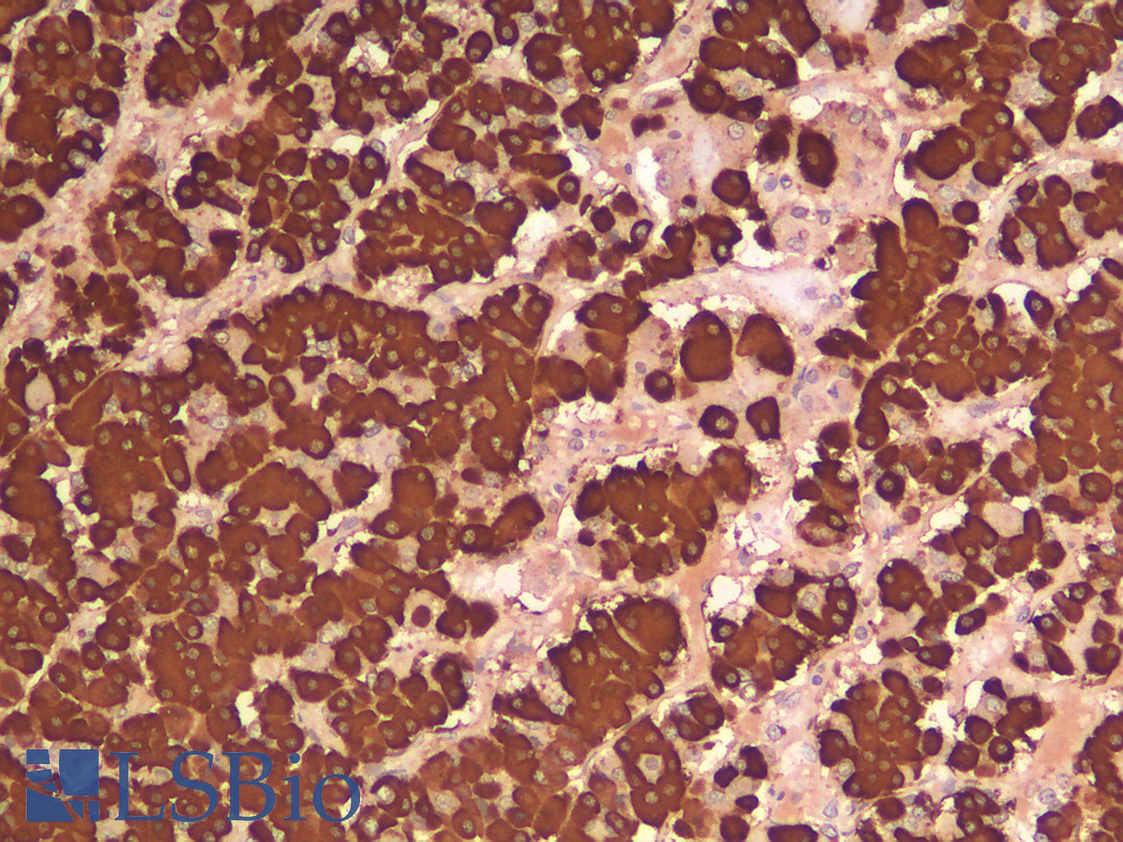 GH / Growth Hormone Antibody - Human Pituitary: Formalin-Fixed, Paraffin-Embedded (FFPE)