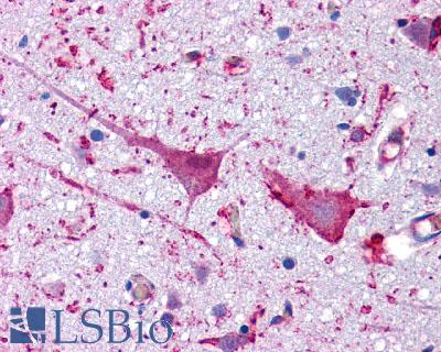 GLP1R / GLP-1 Receptor Antibody - Brain, Cortex, Neurons and Glia