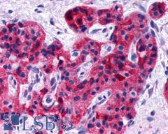 GLP1R / GLP-1 Receptor Antibody - Pancreas, Islet cell tumor