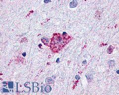 GLP2R Antibody - Brain, Amygdala