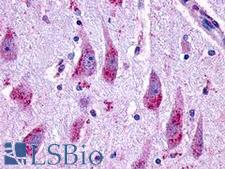 GLP2R Antibody - Brain, hippocampus CA2