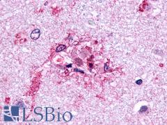 GLP2R Antibody - Brain, Alzheimer's disease senile plaque