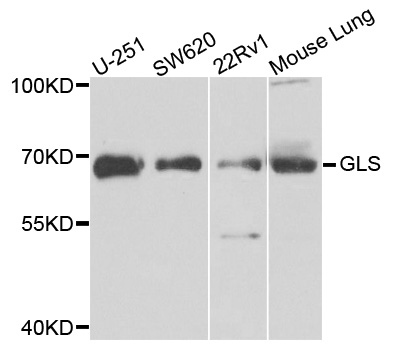 GLS / Glutaminase Antibody - Western blot analysis of extracts of various cells.