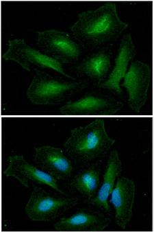 GLUL / Glutamine Synthetase Antibody - ICC/IF analysis of GLUL in HeLa cells. The cell was stained with GLUL antibody (1:100).The secondary antibody (green) was used Alexa Fluor 488. DAPI was stained the cell nucleus (blue).