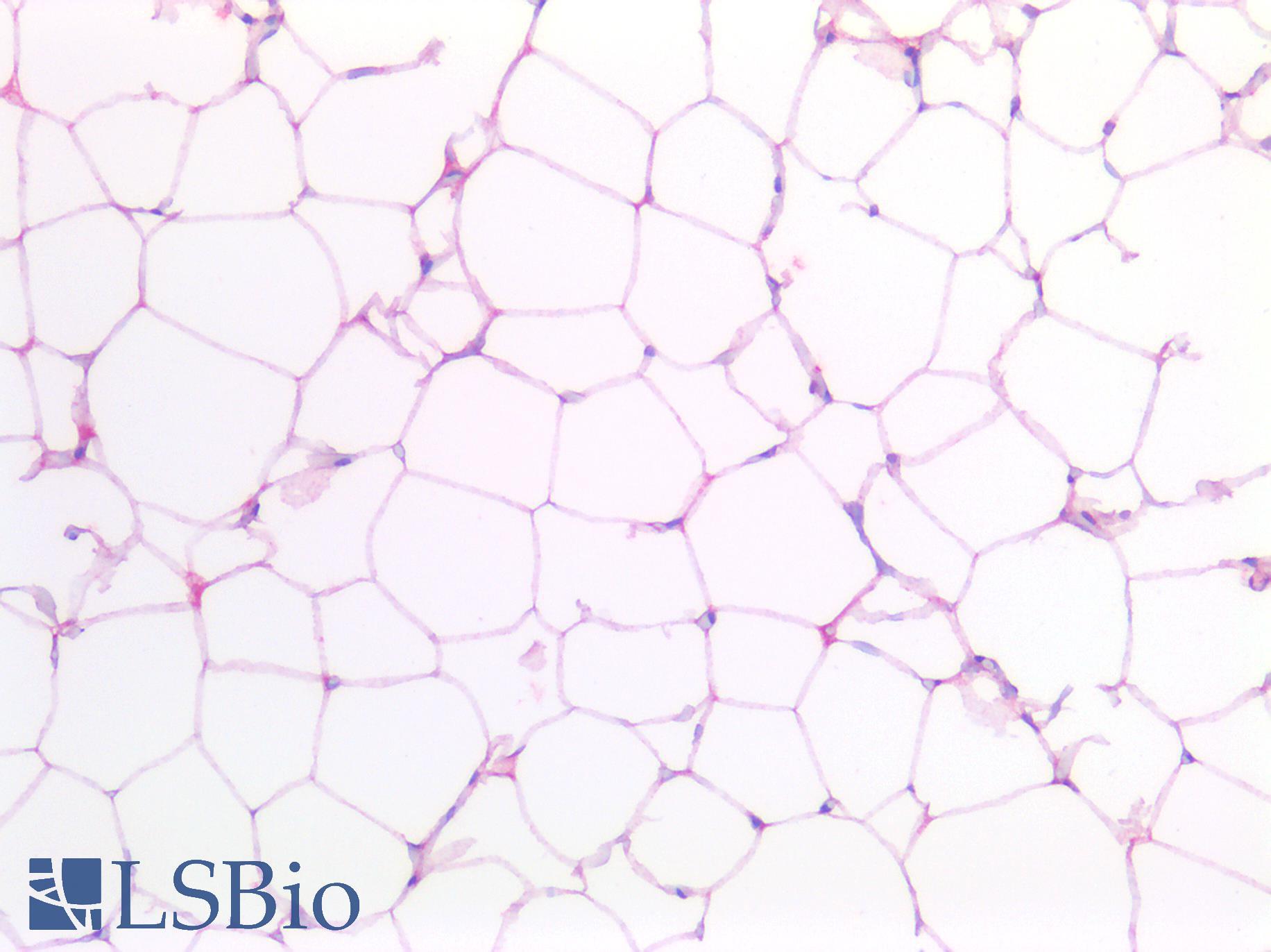 GLUL / Glutamine Synthetase Antibody - Human Breast Adipocytes: Formalin-Fixed, Paraffin-Embedded (FFPE)