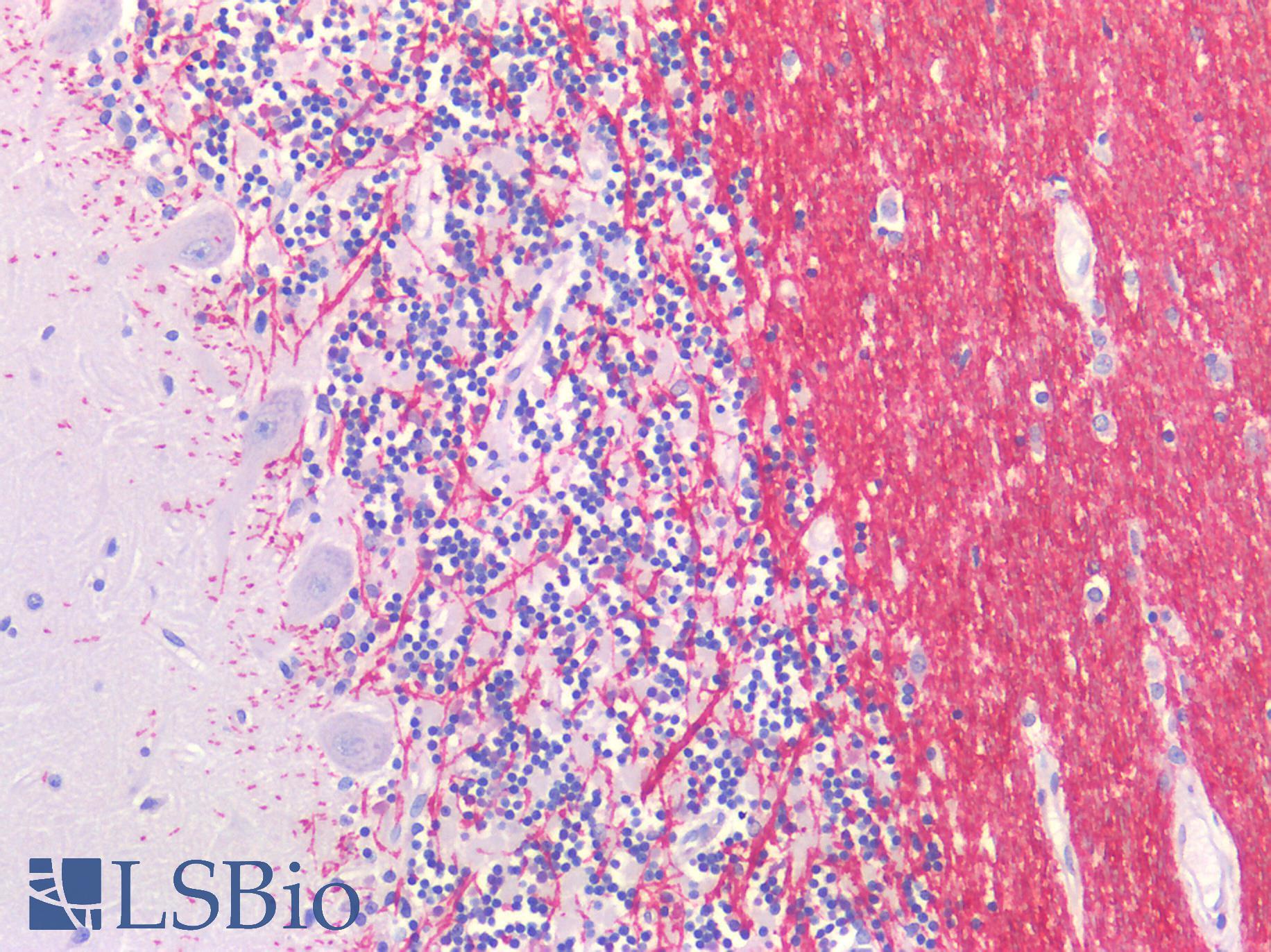 GLUL / Glutamine Synthetase Antibody - Human Brain, Cerenellum: Formalin-Fixed, Paraffin-Embedded (FFPE)