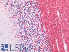 GLUL / Glutamine Synthetase Antibody - Human Brain, Cerenellum: Formalin-Fixed, Paraffin-Embedded (FFPE)