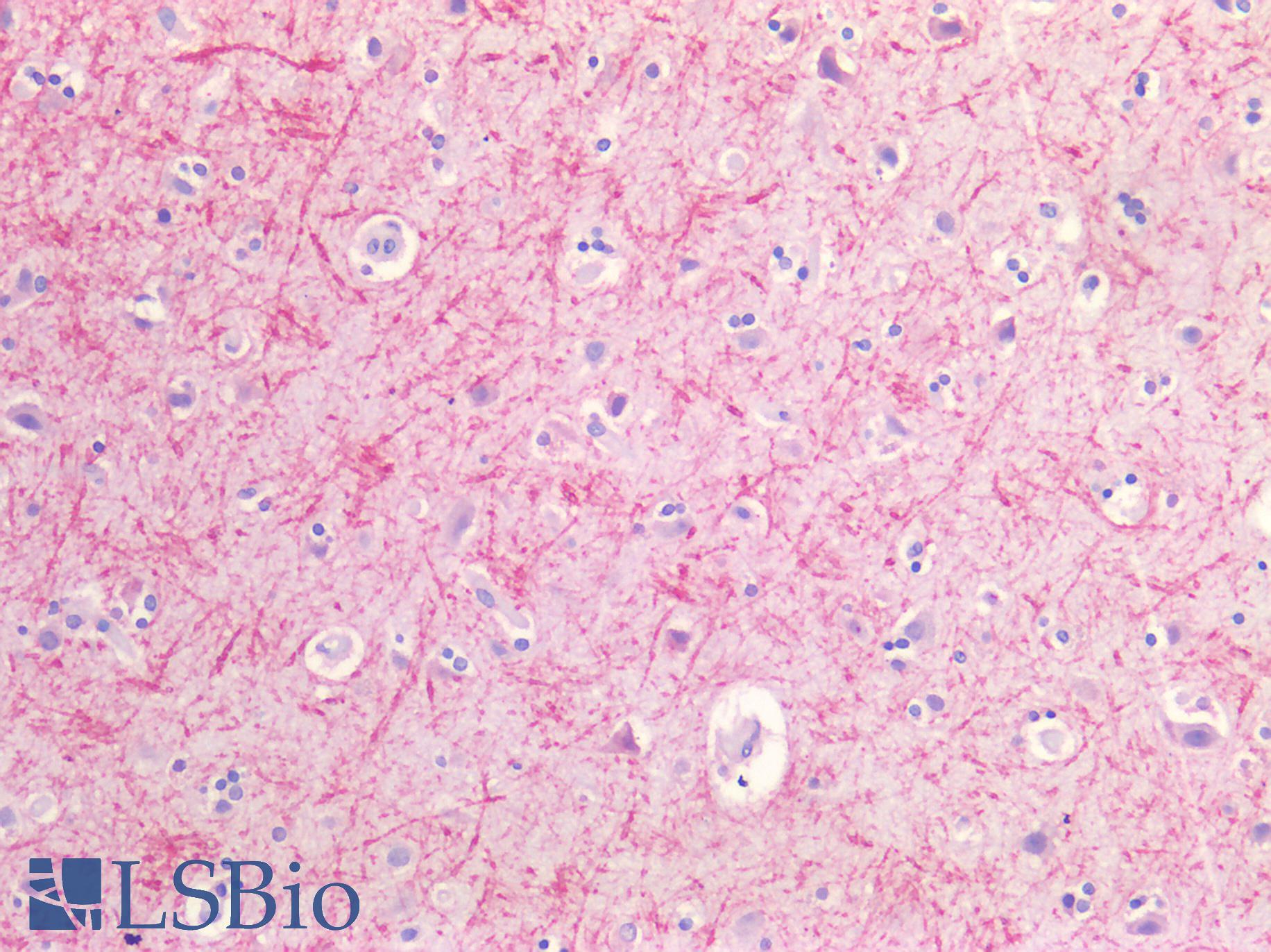 GLUL / Glutamine Synthetase Antibody - Human Brain, Cortex: Formalin-Fixed, Paraffin-Embedded (FFPE)