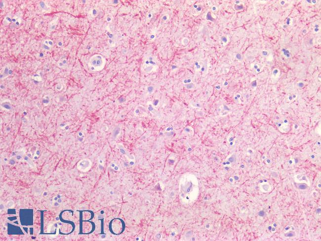 GLUL / Glutamine Synthetase Antibody - Human Brain, Cortex: Formalin-Fixed, Paraffin-Embedded (FFPE)