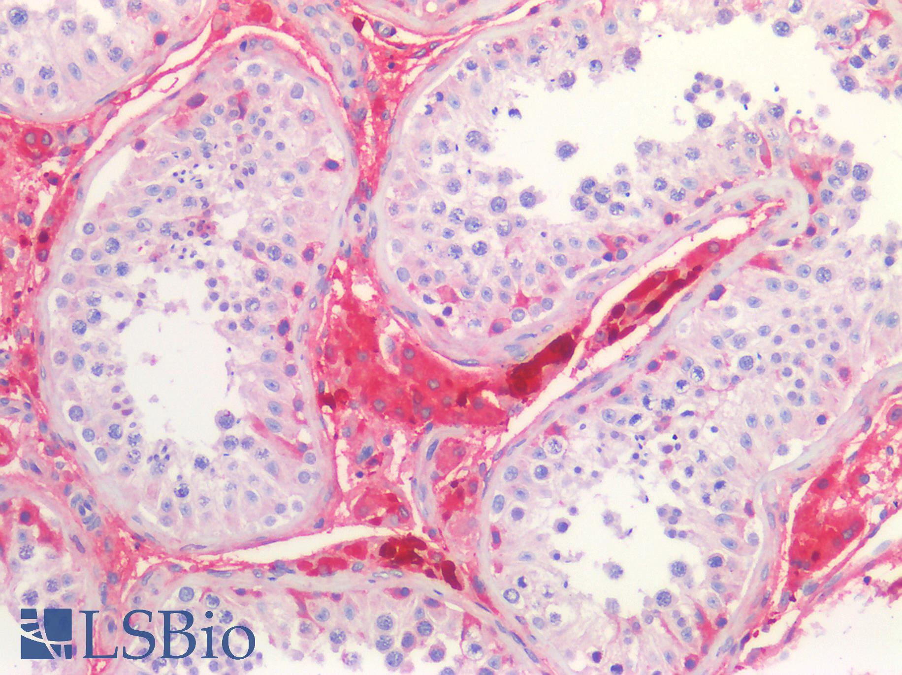 GLUL / Glutamine Synthetase Antibody - Human Testis: Formalin-Fixed, Paraffin-Embedded (FFPE)