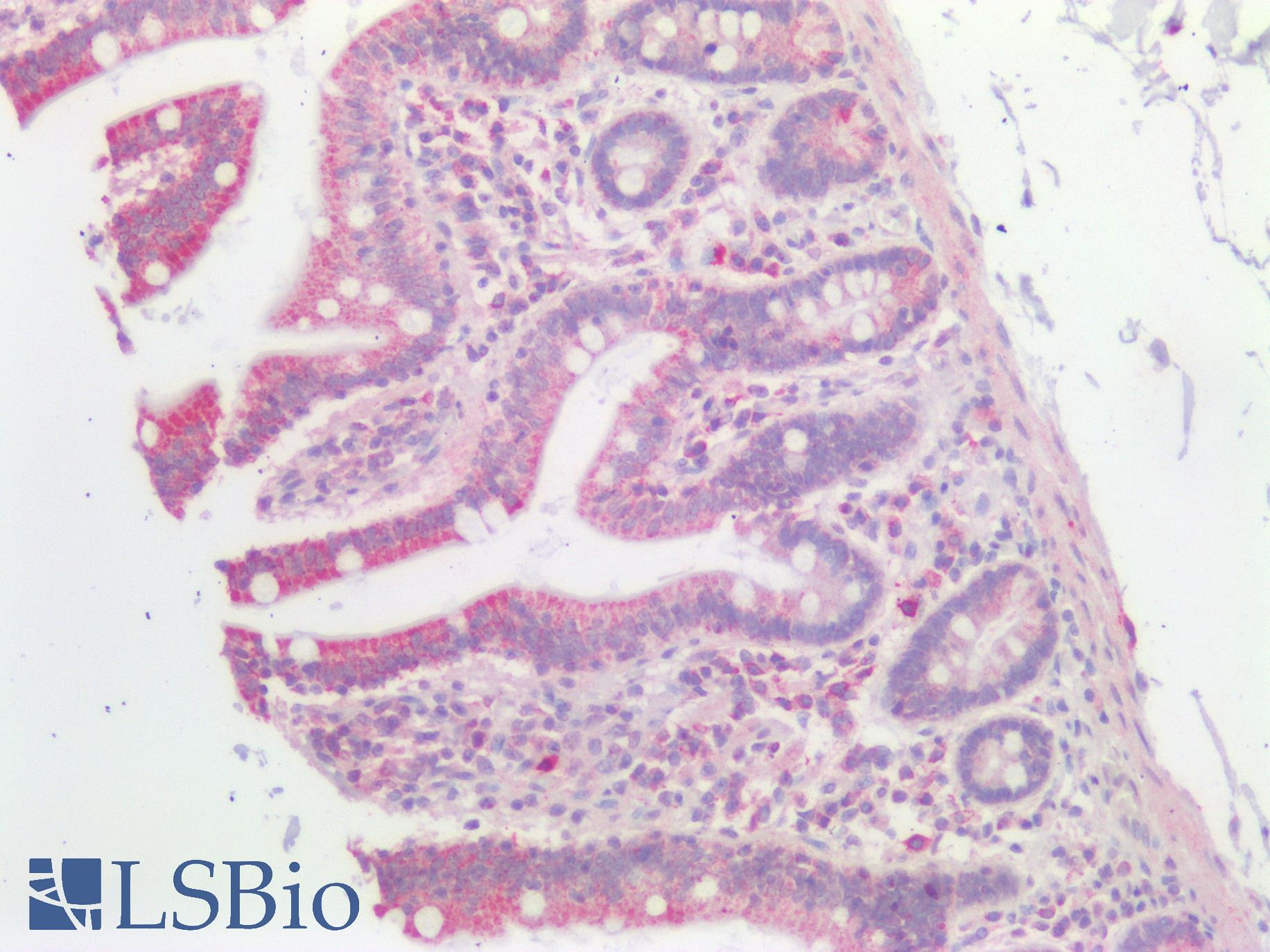 GNAQ Antibody - Human Small Intestine: Formalin-Fixed, Paraffin-Embedded (FFPE)