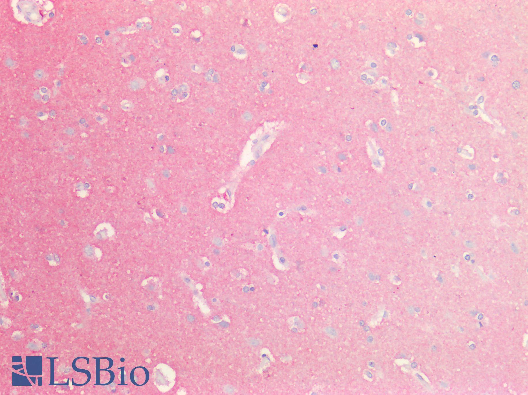 GNAQ Antibody - Human Brain, Cortex: Formalin-Fixed, Paraffin-Embedded (FFPE)