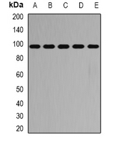 GPBB / PYGB Antibody - Western blot analysis of PYGB expression in SW620 (A); HT29 (B); mouse heart (C); mouse lung (D); rat brain (E) whole cell lysates.