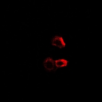 GPBB / PYGB Antibody - Immunofluorescent analysis of PYGB staining in MCF7 cells. Formalin-fixed cells were permeabilized with 0.1% Triton X-100 in TBS for 5-10 minutes and blocked with 3% BSA-PBS for 30 minutes at room temperature. Cells were probed with the primary antibody in 3% BSA-PBS and incubated overnight at 4 deg C in a humidified chamber. Cells were washed with PBST and incubated with a DyLight 594-conjugated secondary antibody (red) in PBS at room temperature in the dark.