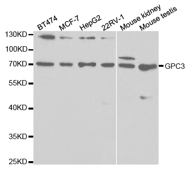 GPC3 / Glypican 3 Antibody - Western blot analysis of extracts of various cell lines, using GPC3 antibody.