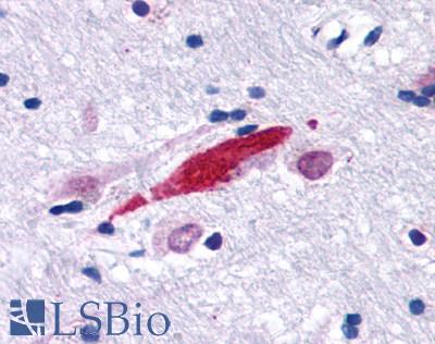 GPER1 / GPR30 Antibody - Brain, Alzheimer's disease neurofibrillary tangle