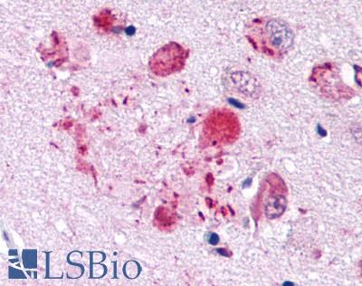 GPER1 / GPR30 Antibody - Brain, Alzheimer's disease senile plaque