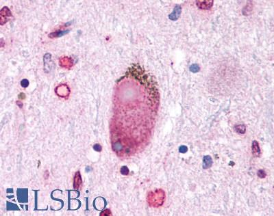 GPER1 / GPR30 Antibody - Brain, Parkinson's Lewy Body