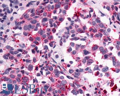 GPR1 Antibody - Breast, adenocarcinoma