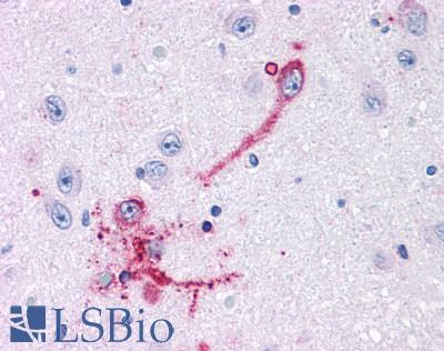 GPR108 Antibody - Brain, Hypothalamus