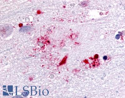 GPR119 Antibody - Brain, Alzheimer's Disease, Senile plaque