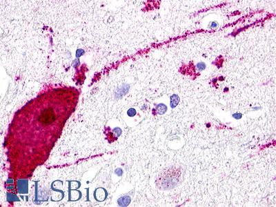 GPR119 Antibody - Brain, Cortex, neurons and glia