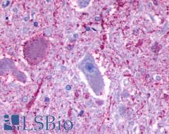 GPR137 Antibody - Brain, Medulla