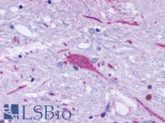 GPR137B Antibody - Brain, Putamen, neurons