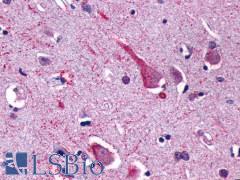 GPR137B Antibody - Brain, cortex, neurons