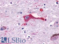 GPR137B Antibody - Brain, Substantia nigra, neuron